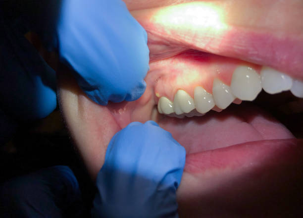 Best Teeth Whitening  in Hugoton, KS