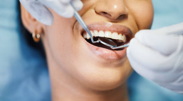 Best Chipped Tooth Repair Near Me  in Hugoton, KS