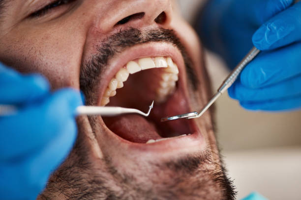 Best Cracked Tooth Emergency Dentist  in Hugoton, KS